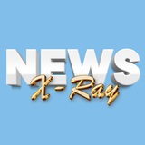 Telegram profile photo for X-Ray News