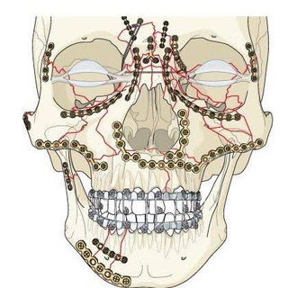 Telegram profile photo for Oral and maxillofacial surgery