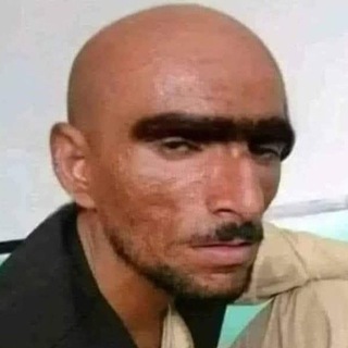 Telegram group profile photo for غمازان پر رايله کړه 🤣 | ټوکی ټکالی | خندا | گروه | ټوکه | چټ | Pashto Jokes | ګروپ | بانډار | افغان | پشتون | تاجک | هزاره |