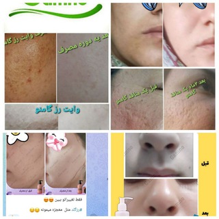 Telegram profile photo for معجزه پوست زیبا_گامنو😍😍🤗🤗