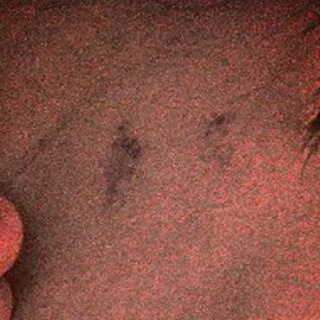 Telegram profile photo for Bloody crazy boy #kbcb49 ©️