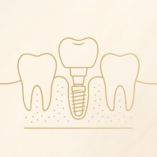 Telegram profile photo for Implant facts