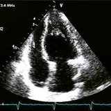 Telegram profile photo for Эхокардиография/Кардиология/Echocardiography/Cardiology🫀👨⚕
