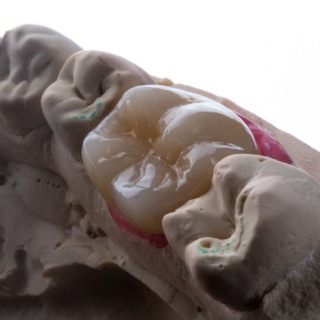 Telegram profile photo for ЗУБНОЙ ТЕХНИК. Моя история🦷