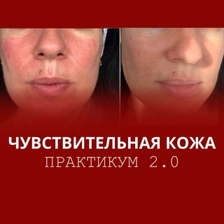 Telegram profile photo for Чувствительная кожа. Практикум 2.0