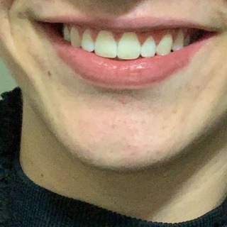 Telegram profile photo for ت