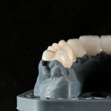 Telegram profile photo for Dental impact🙌🏻🦷
